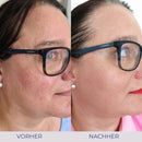 Intensive Care Skin