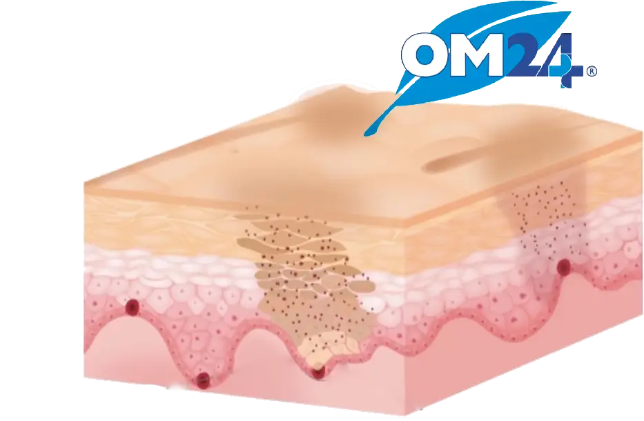 om24-cell