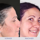 Vorher-Nachher Hautbehandlung mit Intensive Cream für glattere Haut
