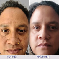Vorher-Nachher Gesichtsbehandlung mit Intensive Cream für strahlende Haut
