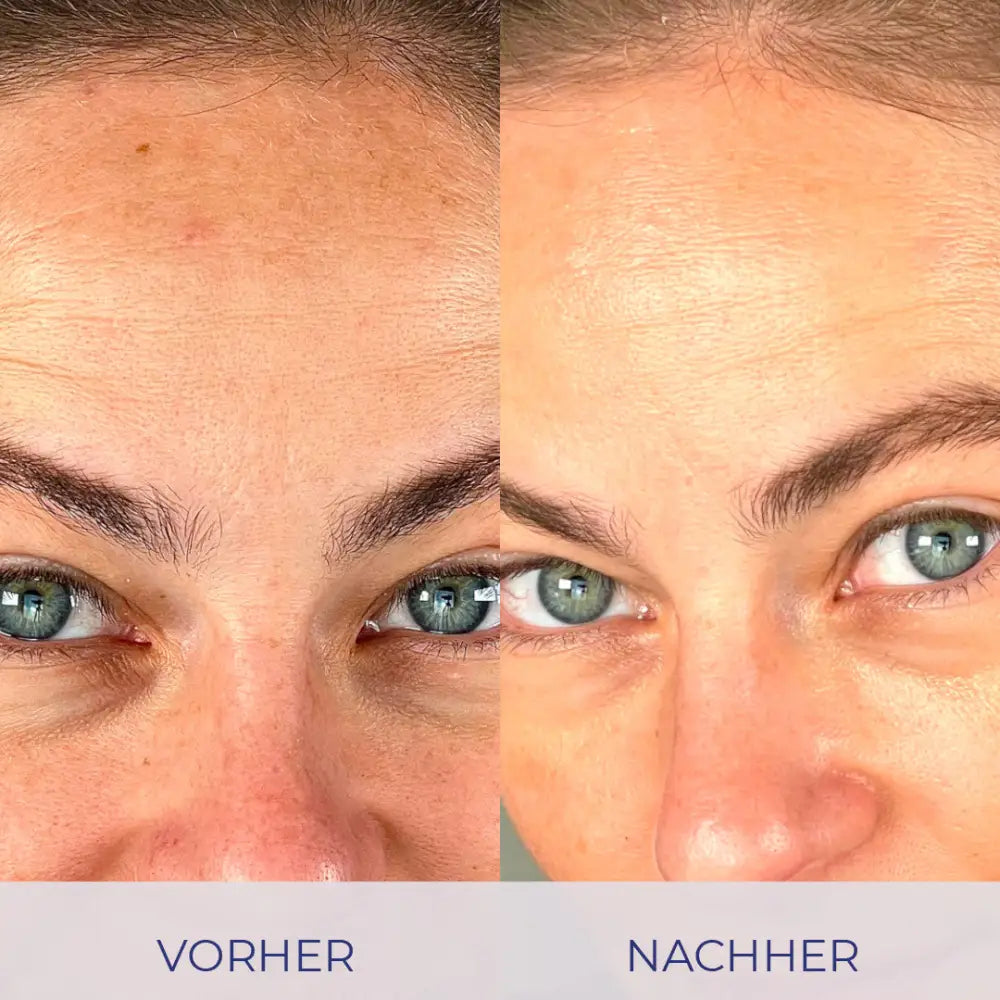 Vorher-Nachher Hautvergleich mit Intensive Cream für strahlende Haut