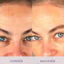 Vorher-Nachher Hautvergleich mit Intensive Cream für strahlende Haut