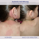 Skin irritation Vergleich mit NOVIGEL Produkt zeigt bessere Hautschutzwirkung